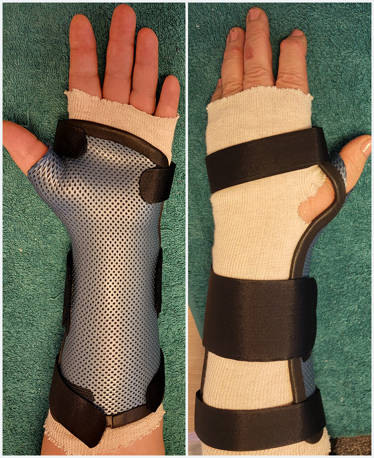 Orthèse de poignet pouce en matériaux thermoformé