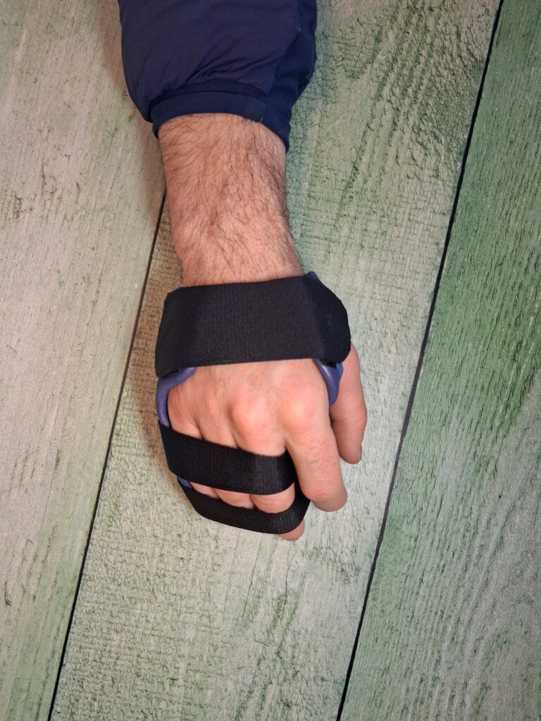 Orthèses thermoformées 1 gantelet palmaire 3 doigts dos