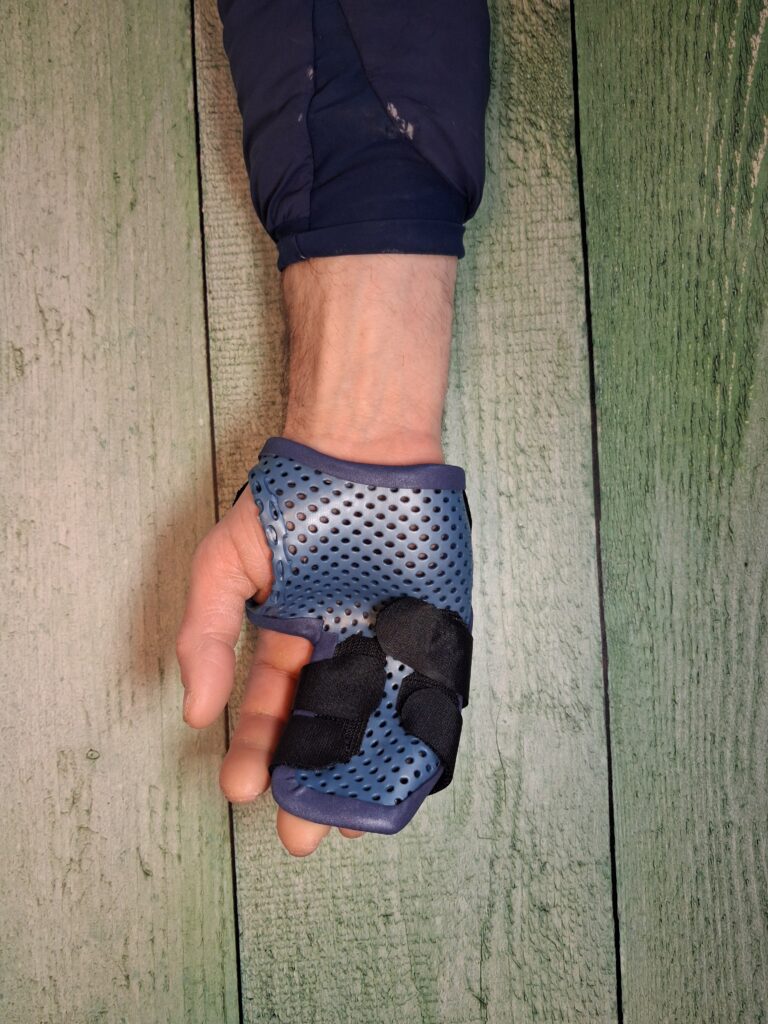 Orthèses thermoformées 1 gantelet palmaire 3 doigts face