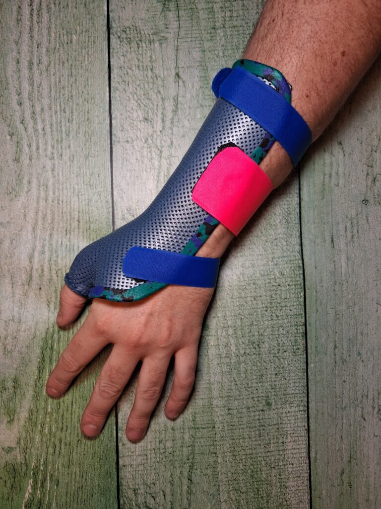 Orthèses thermoformées 2 poignet pouce longue dos