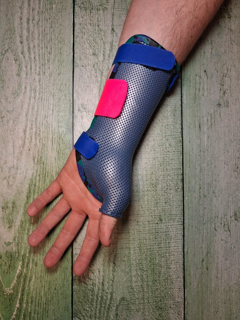 Orthèses thermoformées 2 poignet pouce longue face