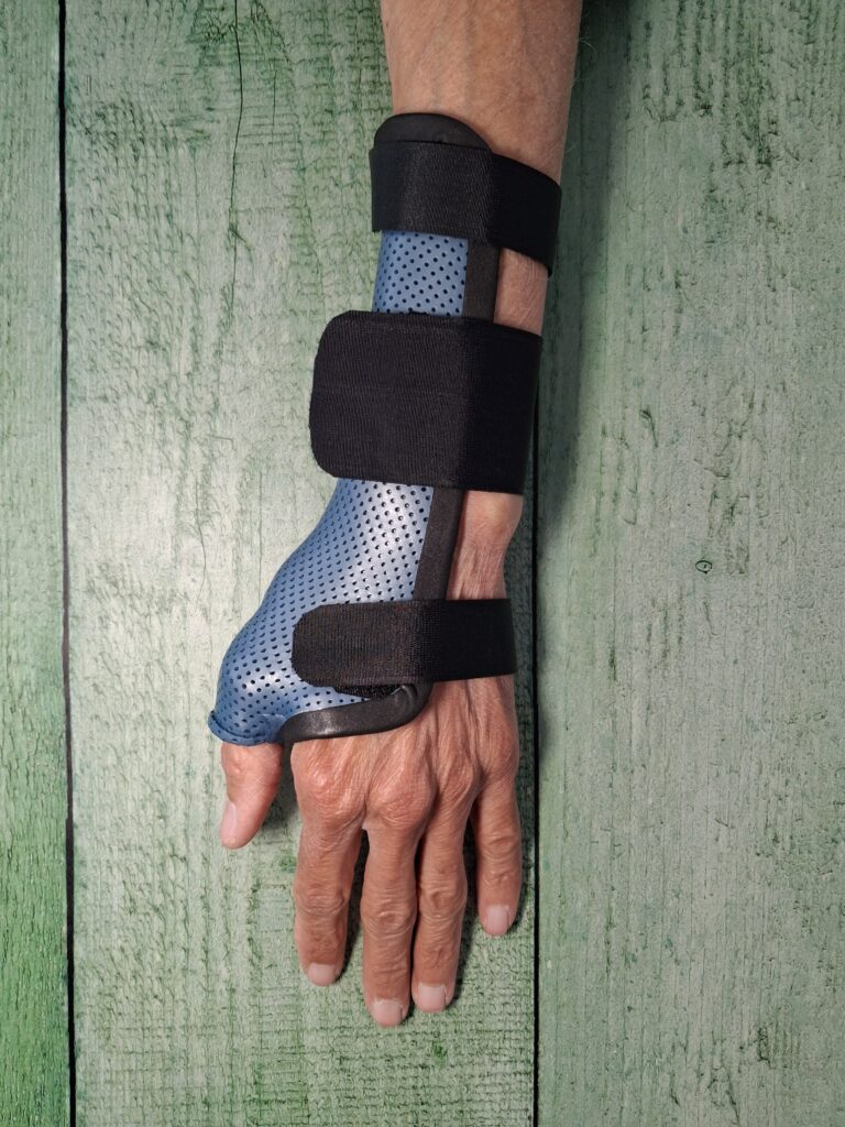 Orthèses thermoformées 20260224 100601