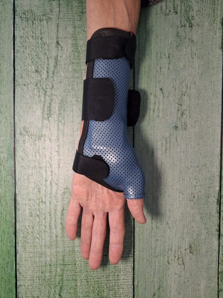 Orthèses thermoformées 20260224 100608