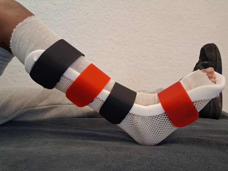 Orthèses thermoformées 20260320 144630