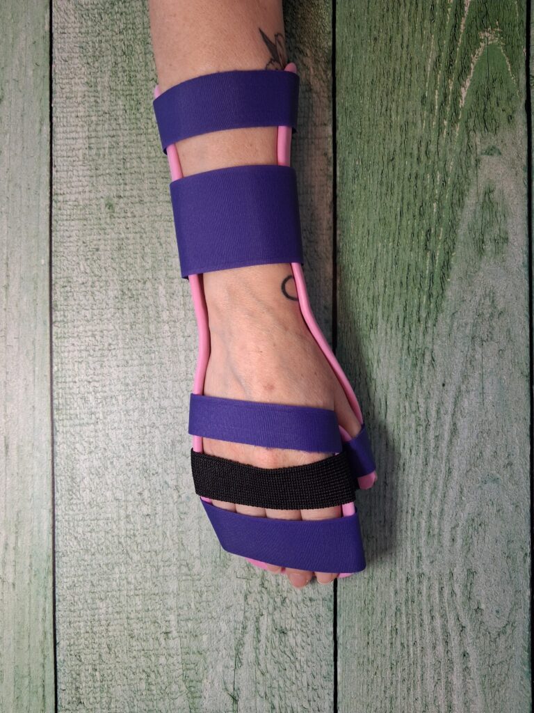 Orthèses thermoformées 20260324 115051