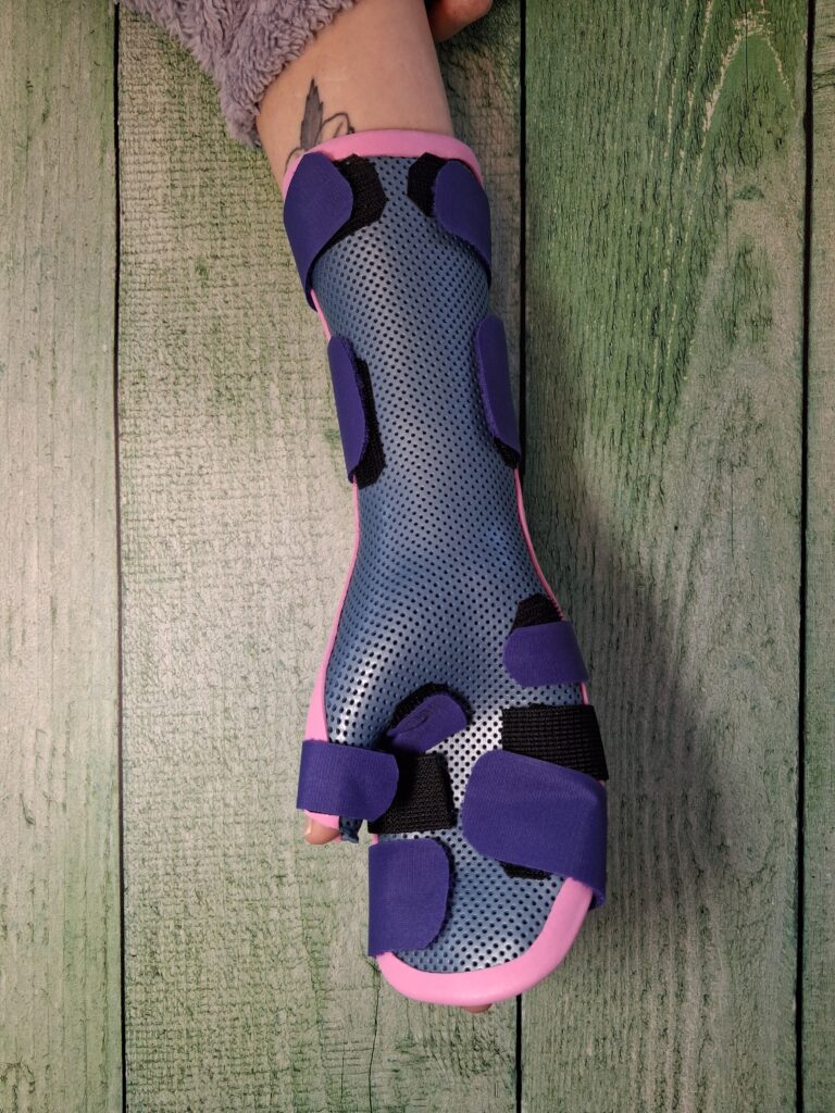 Orthèses thermoformées 20260324 115109