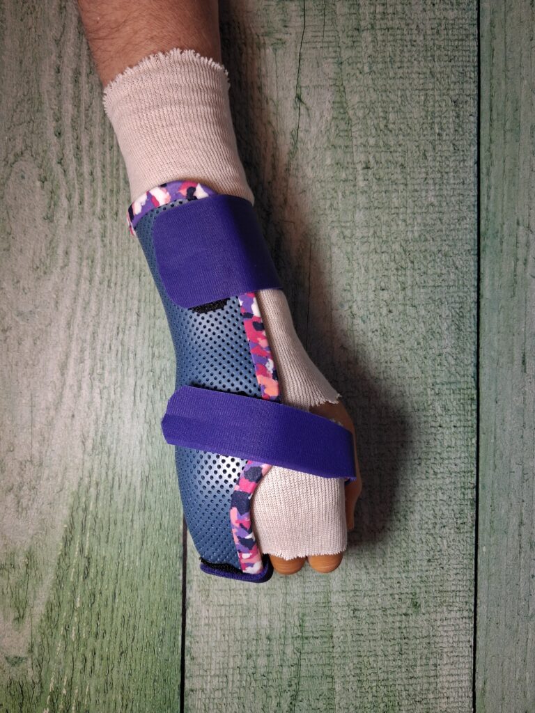 Orthèses thermoformées 20260325 180157