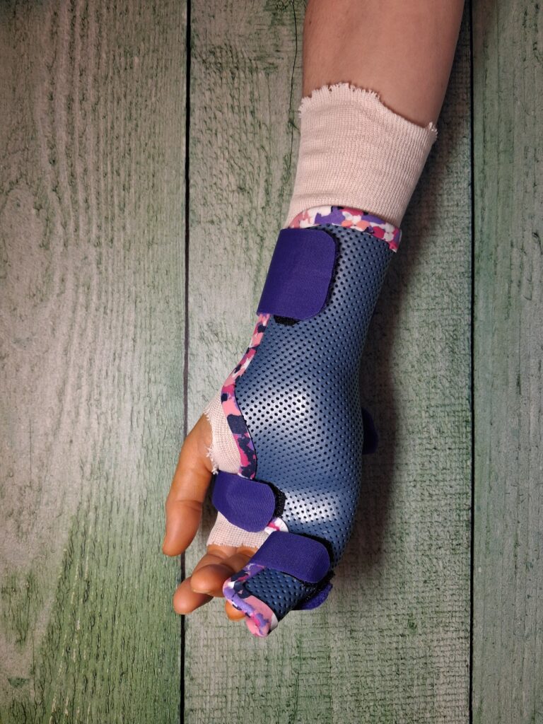 Orthèses thermoformées 20260325 180212