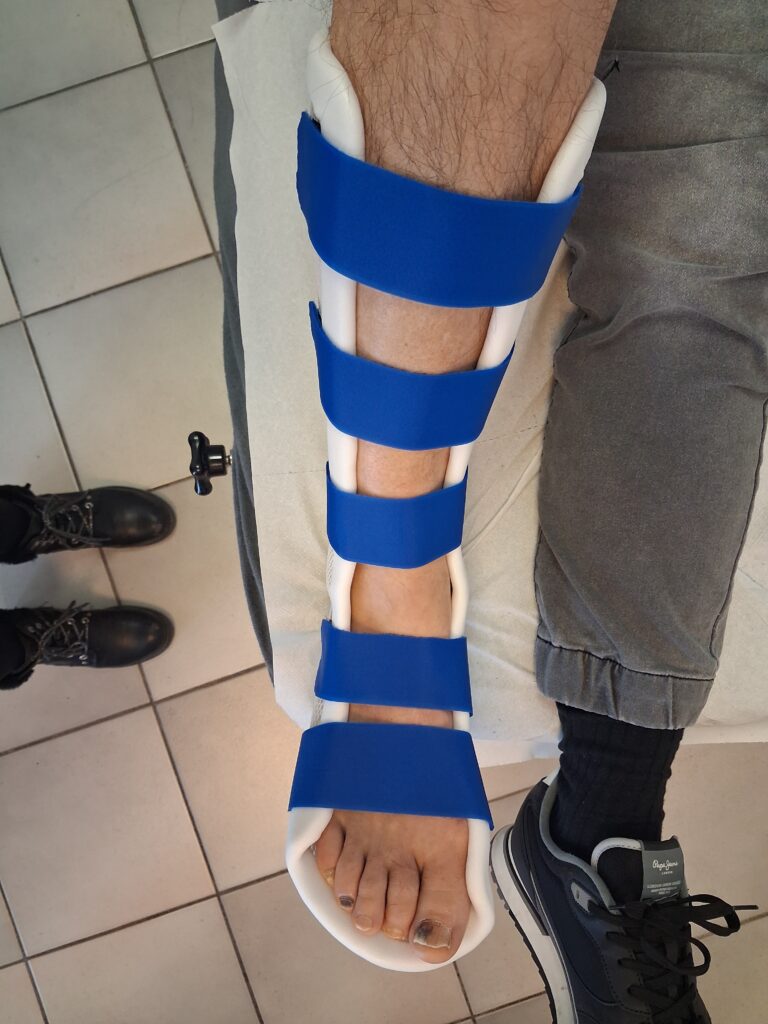 Orthèses thermoformées 20260326 114857