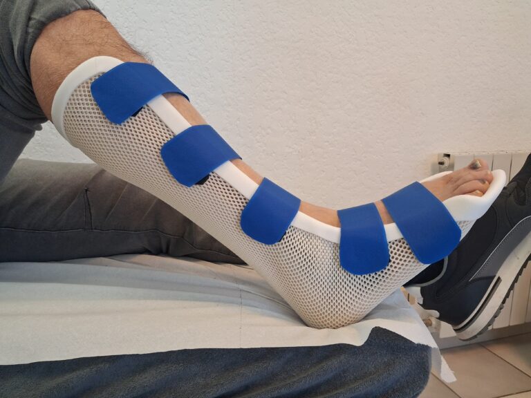 Orthèses thermoformées 20260326 114904