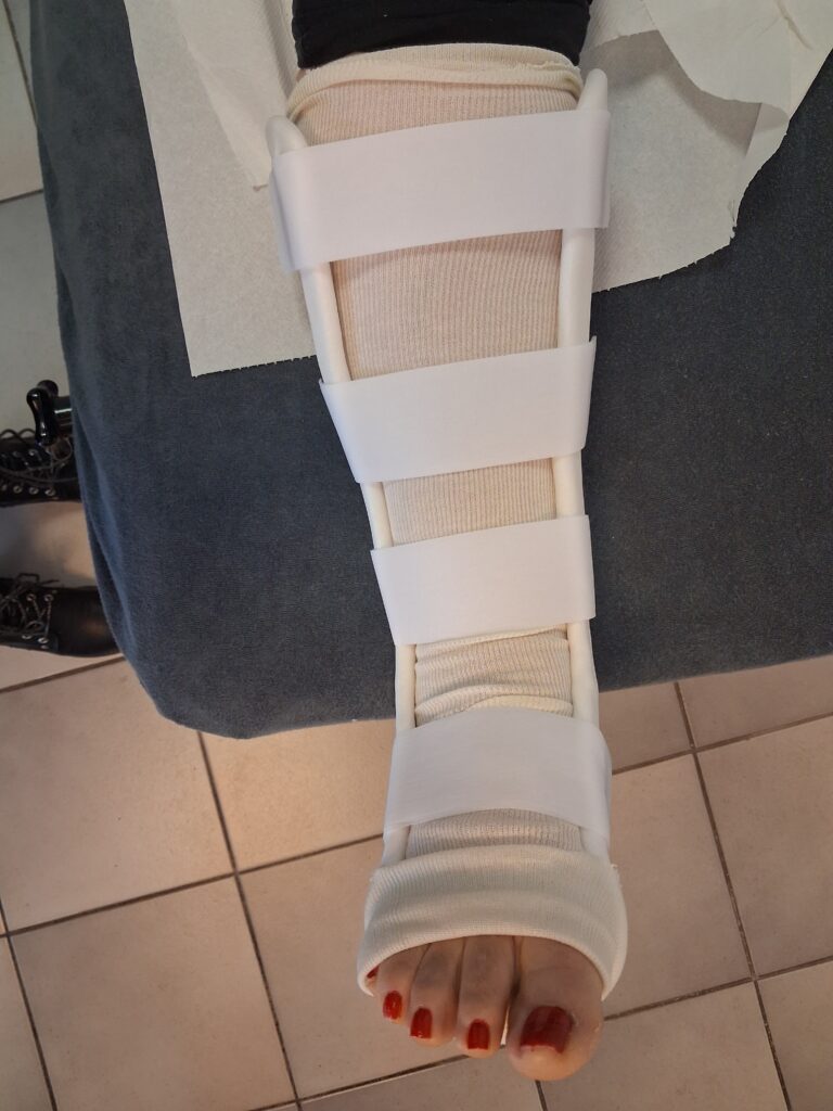 Orthèses thermoformées 3 botte thermo face